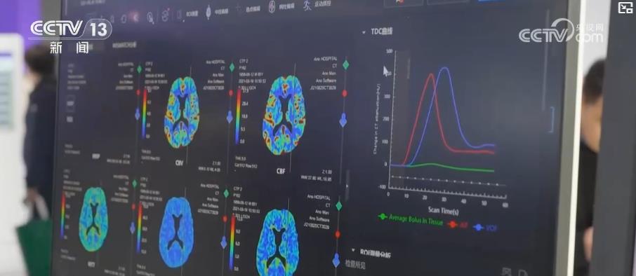  بلغ إجمالي تجارة الاستيراد والتصدير للمعدات الطبية في بلدي 79.1 مليار دولار أمريكي ، بزيادة قدرها 0.71 ٪ على أساس سنوي. من بينها ، بلغ إجمالي حجم تجارة الاستيراد 35.1 مليار دولار ، وانخفاض سنوي بنسبة 5.07 ٪ ، وكان حجم تجارة التصدير 44 مليار دولار أمريكي ، وزيادة على أساس سنوي قدرها 5.85 ٪. في عام 2024 ، بينما نمت صناعة المعدات الطبية في بلدي بسرعة في حجم السوق ، تم تحسين قدراتها على الابتكار الصناعي بشكل مستمر. تمت الموافقة على أنظمة التصوير بالموجات فوق الصوتية داخل القلب ، وعدد من الروبوتات الجراحية ، وأنظمة علاج أيون بروتون ، وما إلى ذلك لأول مرة في الصين. </p> <p class = 