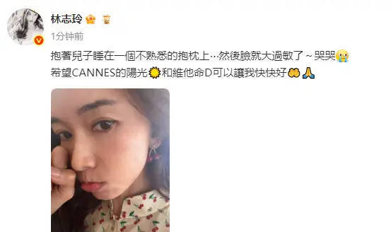 林志玲分享戛纳日常 抱儿子睡抱枕上导致脸过敏
