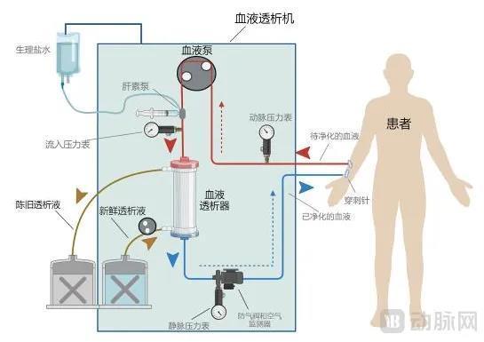 血液透析治疗过程示意图，图片来自于招股书
