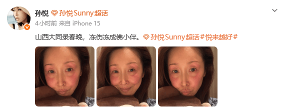 孙悦录节目被冻伤：山西大同录春晚 冻成佛小伴